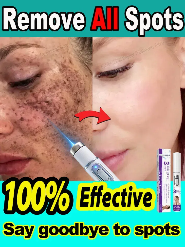 Color: black - ?…?«𝐞𝐜?¤𝐥𝐞 ?«𝐞?¦𝐨𝐯𝐚𝐥 Laser Therapy to Heal Spots