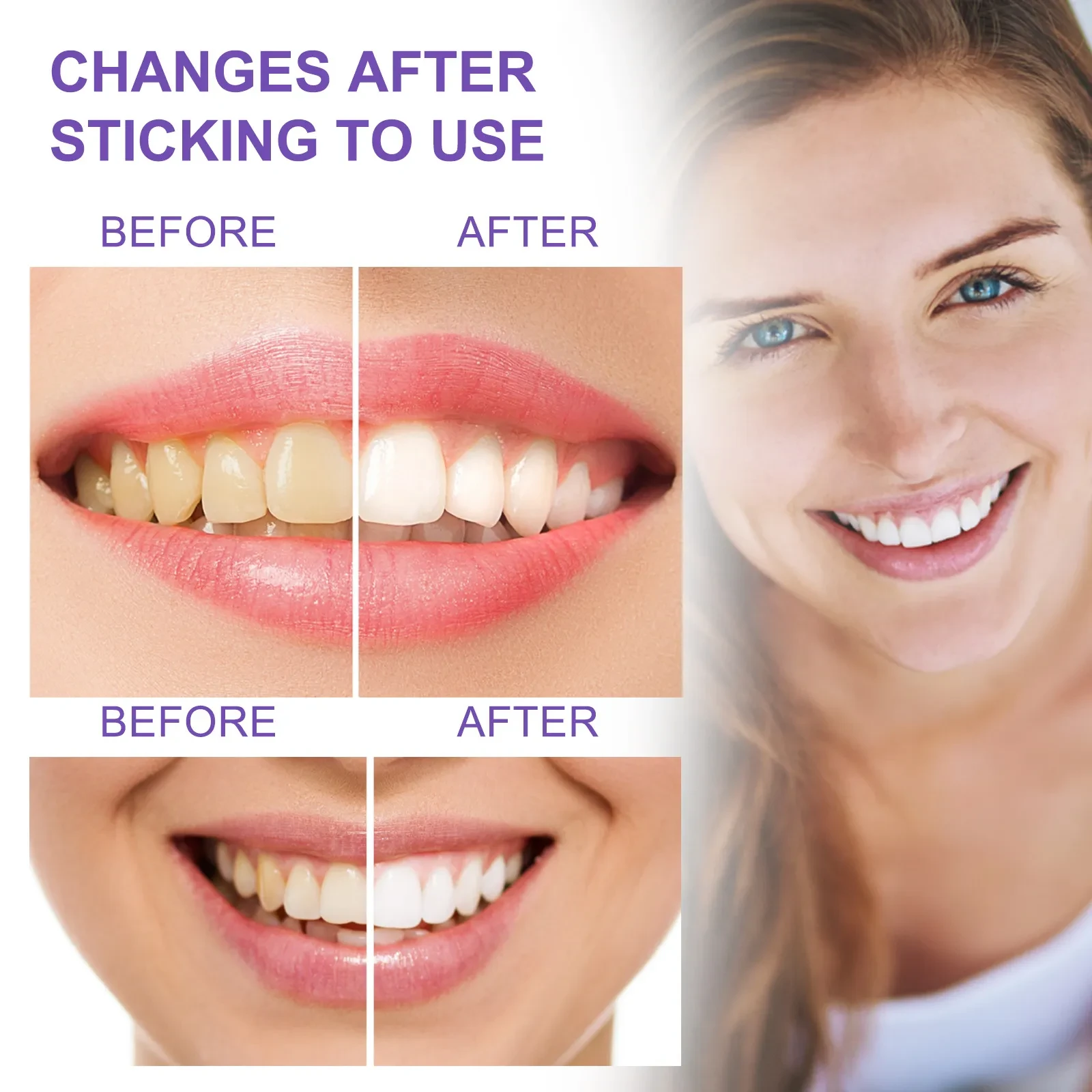 Teeth colour whitening