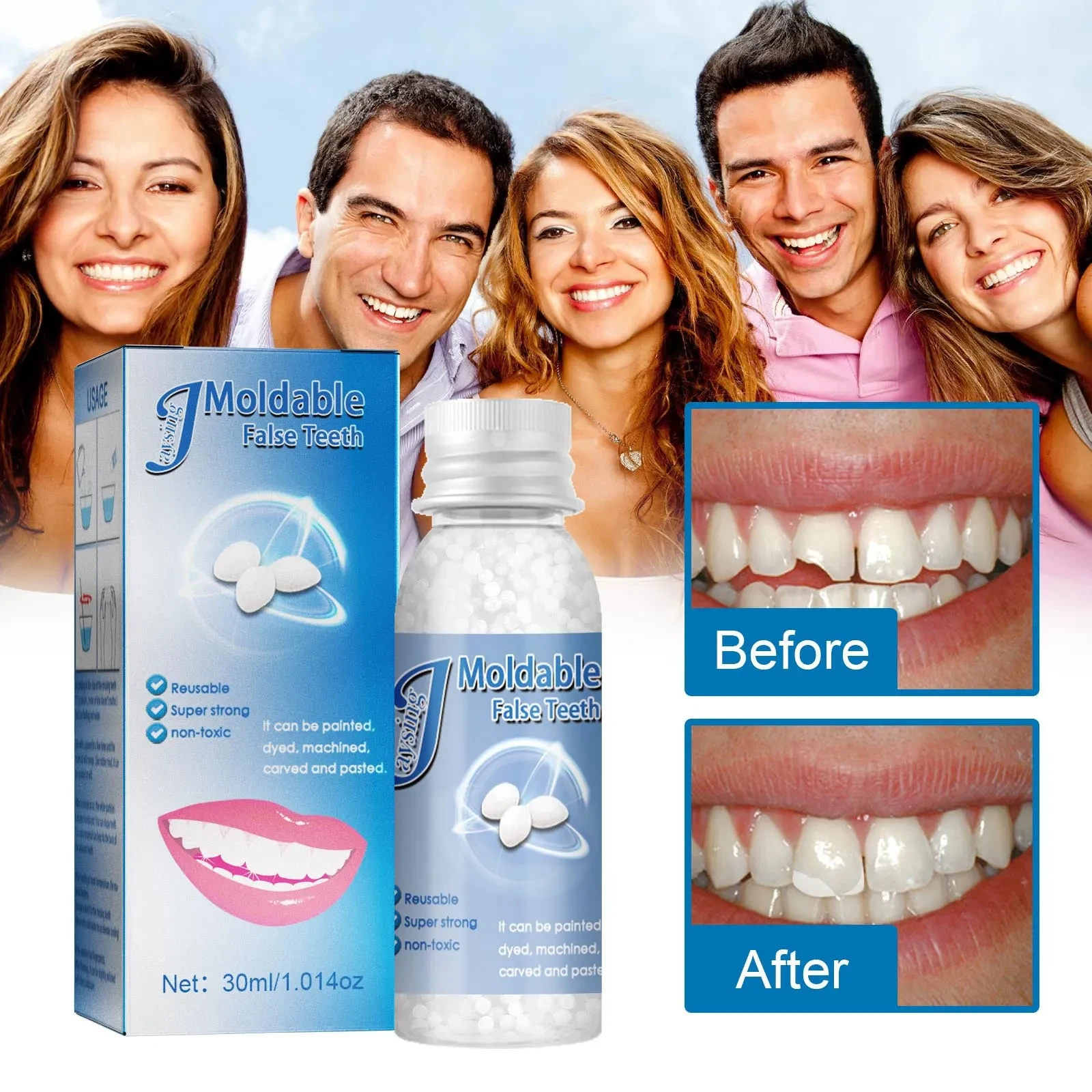 Teeth Gap Filler