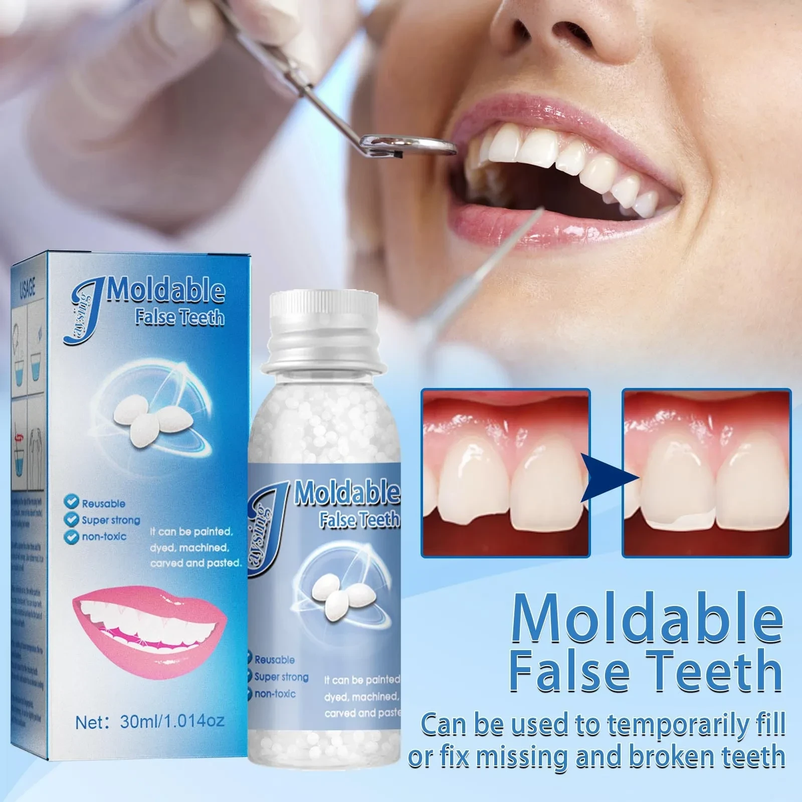 Moldable Temporary tooth Repair Kit