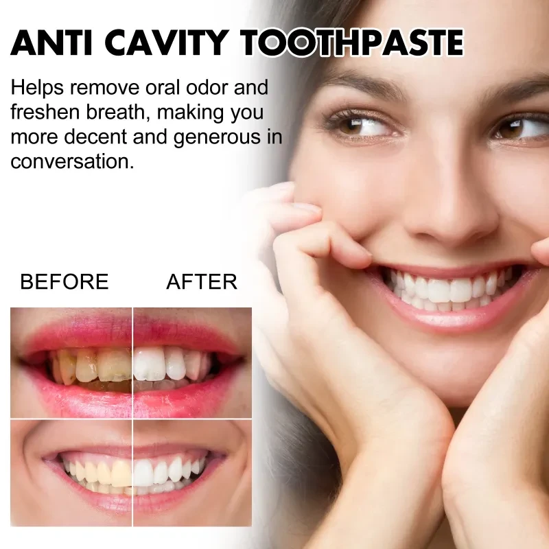Cleaning Tartar Stain Brightening Toothpaste