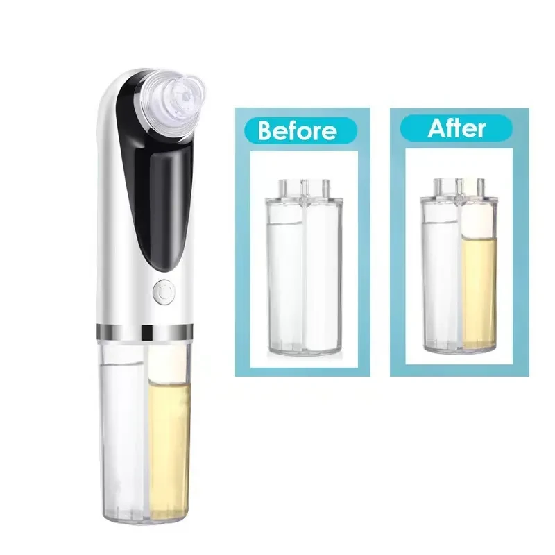 Small Bubble Blackhead Apparatus Beauty